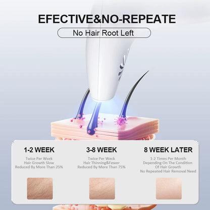 Handheld laser hair removal instrument (women's photon skin rejuvenation)